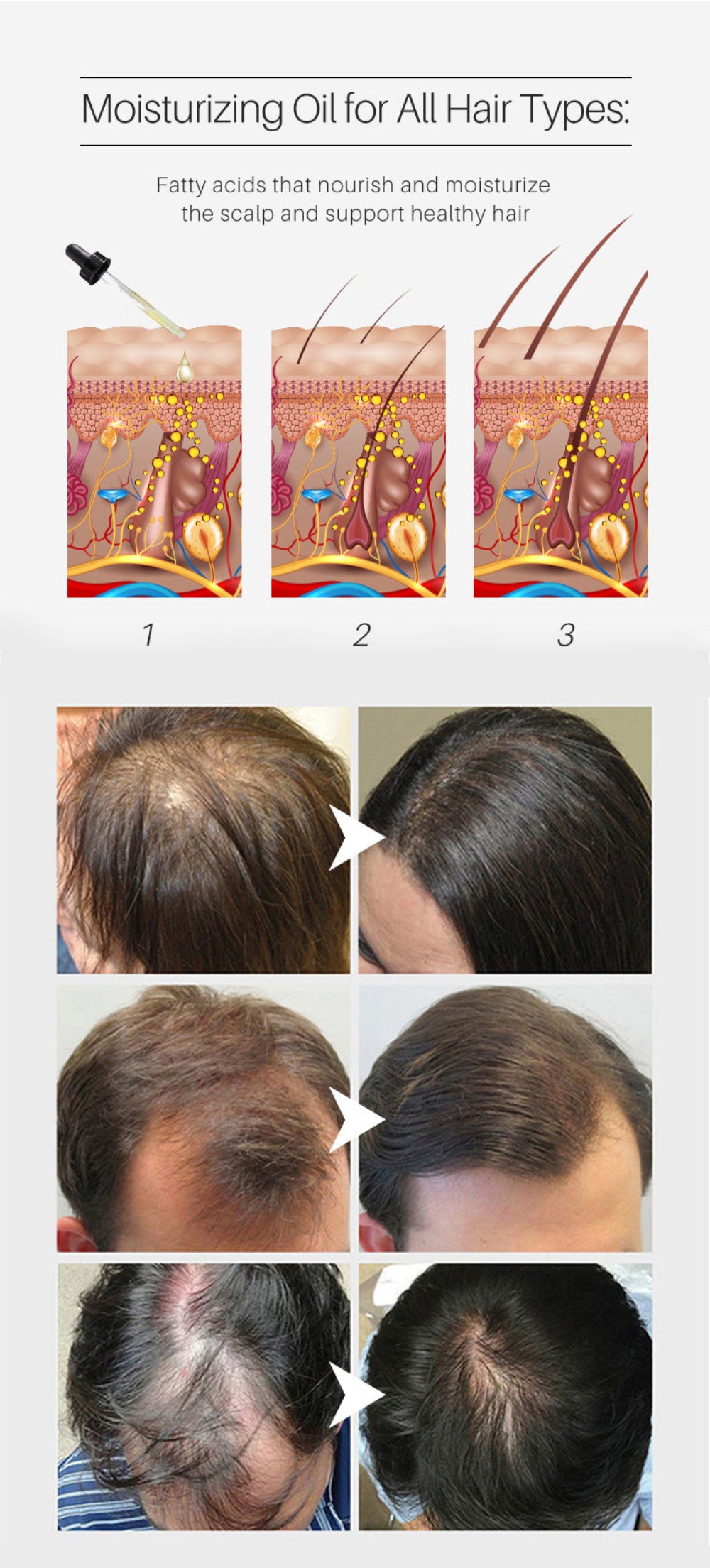 revive massager onion hair oil