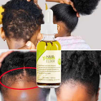 Radiant Roots Rosemary Blend Hair Growth Oil