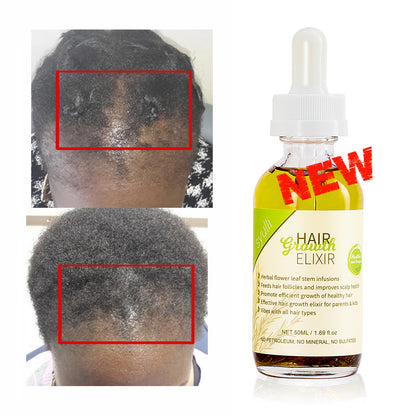 Radiant Roots Rosemary Blend Hair Growth Oil